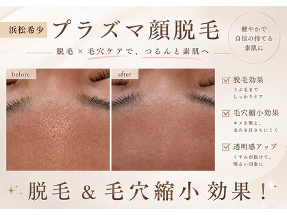 アール(ar.)の写真