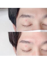 リヨン(LYON+831)/