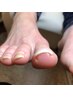 【フット巻き爪補正ケア】つらい足の巻き爪に。1本¥2,400（ブログ記事参照）