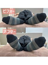 リボーン(Be.Reborn)/つま先の開きすぎは骨盤のゆがみ