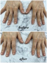 リジェネ(Regene)/