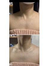 ブルーコーラル エム(BLUE CORAL M)/首肩まわりもスッキリ