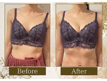 マリン(MARINE)/Before→After