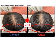 匠 桜中目黒駅前整骨院の雰囲気（絶壁頭の悩みもご相談ください！中目黒/整体/腰痛/肩こり/猫背）