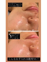 ビューティサロン アール(R)/継続しやすいお手入れ方法