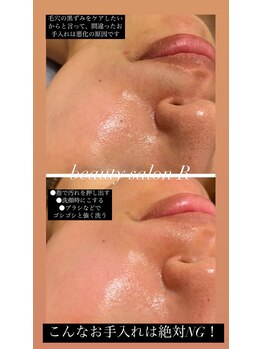 ビューティサロン アール(R)/継続しやすいお手入れ方法