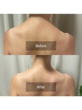 アンフェム(Anfem)/オイルリンパビフォアフ5