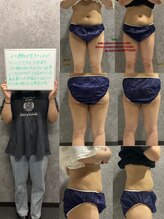 リボーン(REBORN)/産後ケアーダイエット