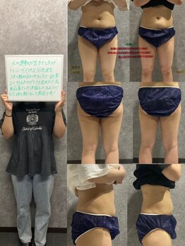 リボーン(REBORN)/産後ケアーダイエット