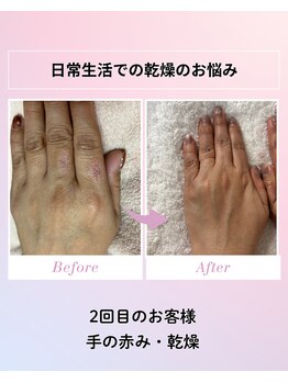 フルールスレーヌ(Fleur Sereine)/ハンドケア