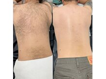 リボーン(REBORN)の雰囲気(LED脱毛/リンパ/EMS/痩身/全身ヒートパック/毛穴ケア/頭浸浴)