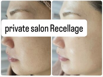 リセラージュ(Recellage)/毛穴洗浄×ハーブ×グロッティ