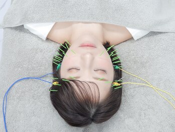 ハリカ 恵比寿 代官山店(HARIKA)の写真/妥協なしの【美容鍼×小顔矯正×整体】むくみ・エラ張りを根本改善！本物志向のためのオーダーメイド施術◎