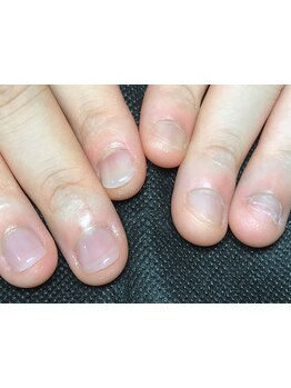 爪の悩みを解消できる（ケア含む）