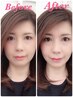 【耳ツボクーポン】リフトアップ、その他。
