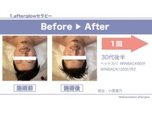 アフターグロウ(afterglow)/癒しのヘッドスパ♪