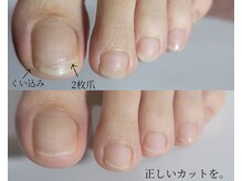 阿良波々岐(アラハバキ)/≪フットケア≫キレイを維持！