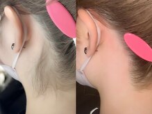 ネリネ 天神(nerine)/オススメうなじワックス脱毛☆