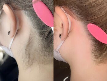 ネリネ 天神(nerine)/オススメうなじワックス脱毛☆