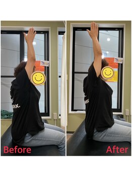 サンテ鍼灸院 整骨院/before/after