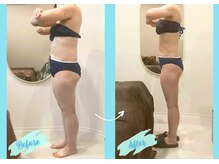 千歳の女神 岡崎店/【施術風景】Before/After