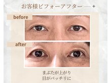 プランドール/下がりがちな瞼がパッチリに