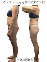 痩身革命 大宮店/ダイエットリンパマッサージ