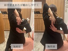 ル キヤ アイスペシャリテ ハービスENT店/【ビフォーアフター】肩こり改善