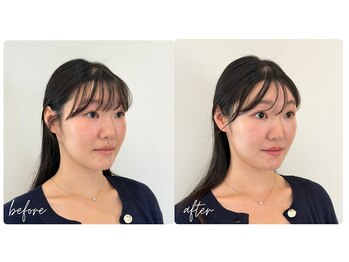 スタイルキューピット(style cupit)/メイクビフォアフター＊20代