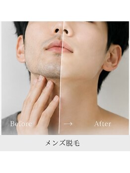 シュガーリングハウス ベル(Bell)の写真/【メンズ脱毛も大歓迎】清潔感は脱毛で整える！毎朝のヒゲ剃りをもっとラクに。各パーツごとの脱毛も可能◎
