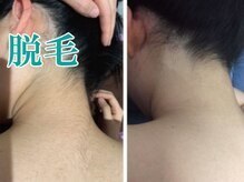 レディース ビホウ(BIHOU)/