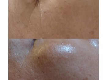 コールドゥ(Coeur-Doux)/眼周りが張ってふっくら☆