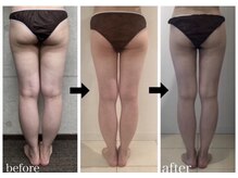 美人バスト 川崎店/【痩身・ダイエット】 川崎/脚☆