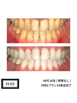 レオン 磐田(REON)/◇ お客様 before＆after ◇