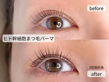 アオ(ao)/ヒト幹細胞まつ毛パーマ