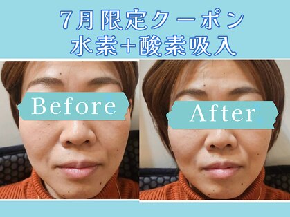 ヨサパーク ラ エトワール 広畑店(YOSAPARK)の写真