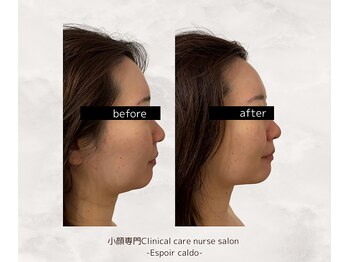 エスポワールカルド(Espoir caldo)/