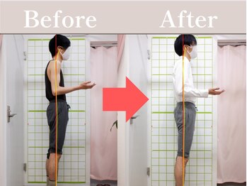 やわた姿勢整体院/25歳男性