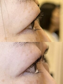 ダーム ド ローズ(Dame de rose)/【まぶたが上がるまつ毛パーマ】