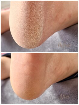 ソワン(soin)/Before→After