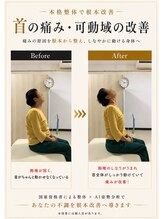 ナオル整体 八王子院(NAORU整体)/70代女性【首の痛み】