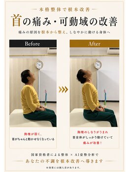 ナオル整体 八王子院(NAORU整体)/70代女性【首の痛み】