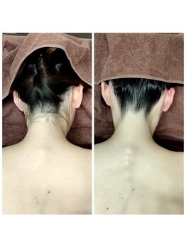 サロン ピューパ(Salon pupa)/花嫁様うなじ　Before→After