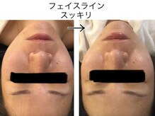 テールボーテ(Terre beaute)/スッキリ☆
