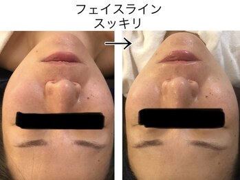 テールボーテ(Terre beaute)/スッキリ☆