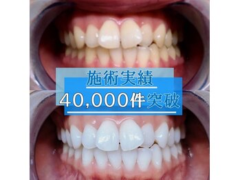 ライトケアサロン 表参道店(Light Care Salon)/施術実績多数のホワイトニング店