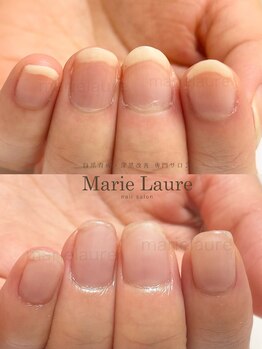 マリーロール 淀屋橋本店(Marie Laure)/自爪育成/深爪矯正/ネイルケア