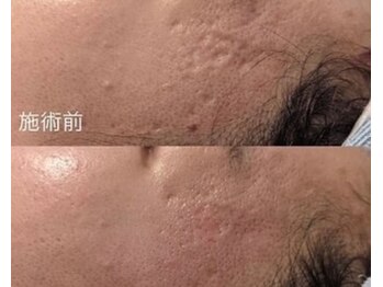 オームの森 北浜/どんどん薄くしていきましょう