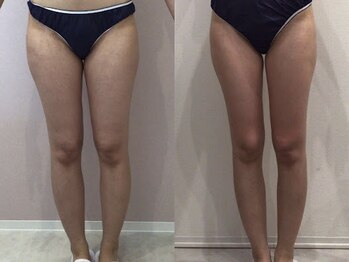 ビラ 銀座店(BILA)/キャビラジ