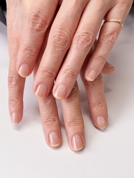 爪の悩みを解消できる（ケア含む）